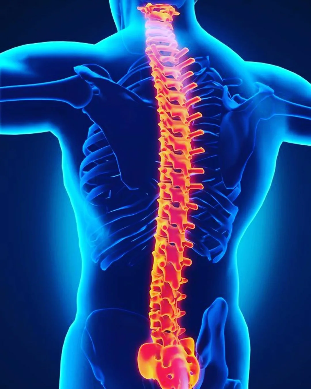 General Spine Surgery