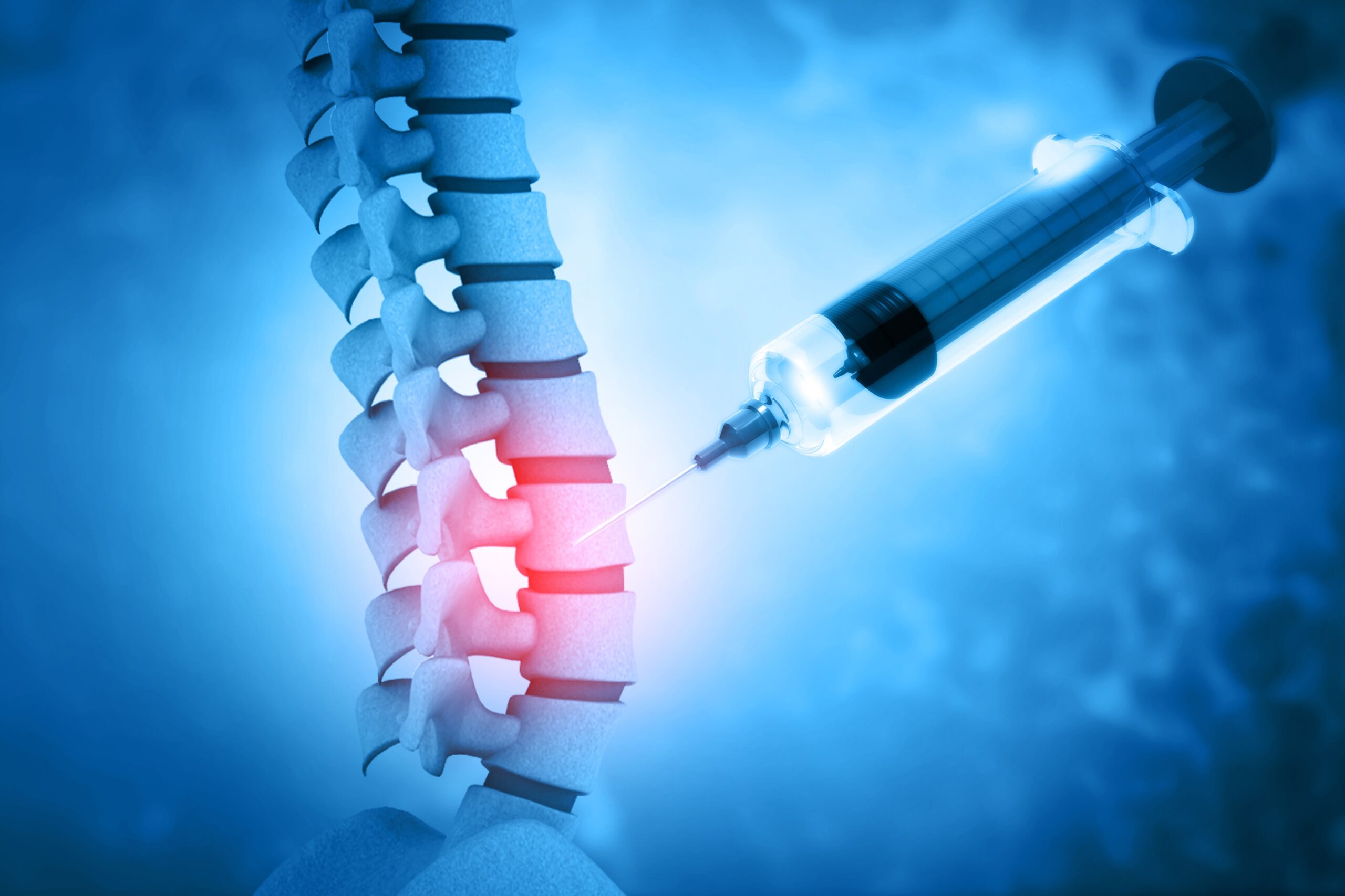 Spine Injections